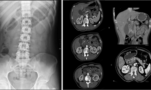 CT Scan Image