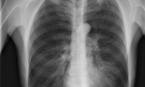 xray image